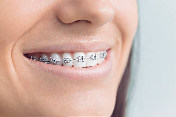 Best Dental Exams and Cleanings  in Mishawaka, IN